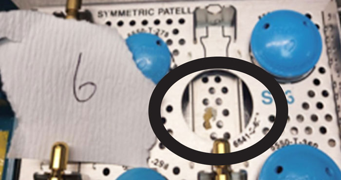 Example of Bioburden Found by LoanSTAR Specialists Example of Bioburden Found by LoanSTAR Specialists