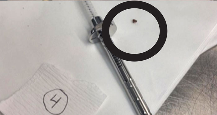 Example of Bioburden Found by LoanSTAR Specialists Example of Bioburden Found by LoanSTAR Specialists